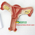 SELL 12443 Model Uterus Show Female Genital Structures Uterine Anatomy Model